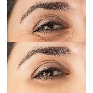 biotic repair eye treatment