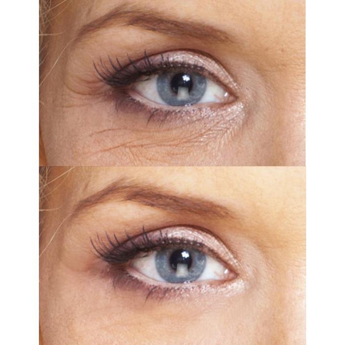 biotic repair eye treatment