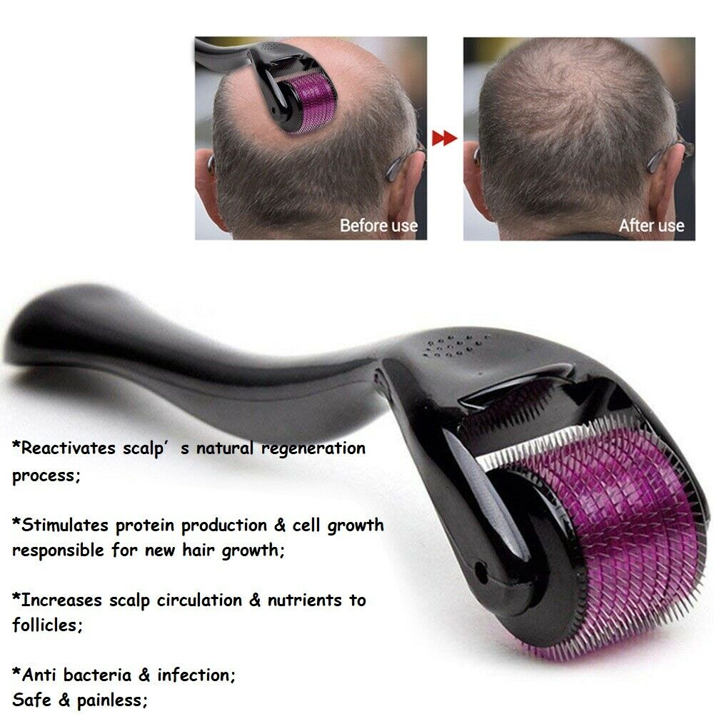 (540 needles) derma micro needle titanium roller for acne hair loss